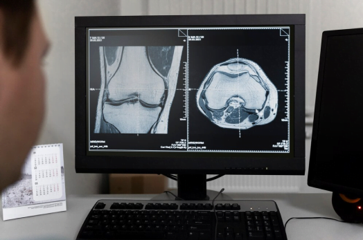 radiografia